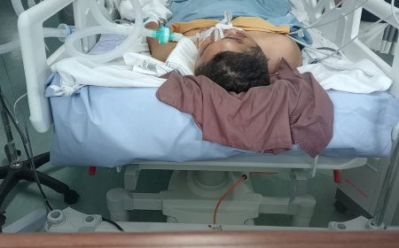 Ditabrak, Guru SMK N 1 Bangkinang Belum Sadar Diri